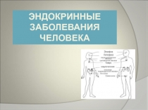 Презентация по анатомии на тему Зндокринные заболевания человека