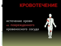Презентация по ОБЖ Оказание первой помощи Кровотечение