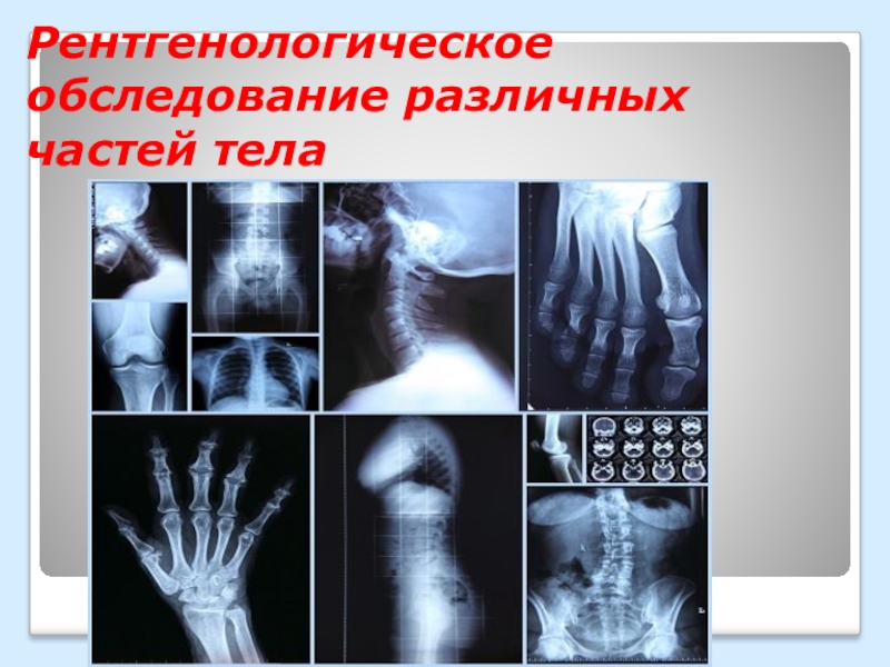 Рентгенологическое обследование различных частей тела