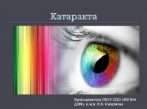 Катаракта