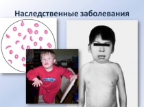 Презентация по биологии: Наследственные болезни