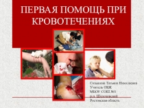 Презентация по ОБЖ Первая медицинская помощь при кровотечениях (5 класс)