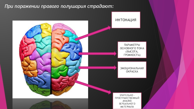 Поражение левого полушария мозга. Правое полушарие. Полушария мозга. Поражение правого полушария. Полушария мозга речь.