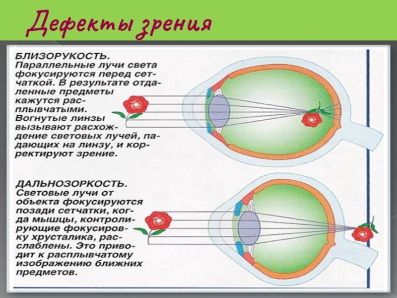 Доклад по физике на тему зрение. Дефекты зрения дальнозоркость и близорукость и их коррекция. Дефекты зрения близорукость. Дефекты зрения дальнозоркость физика. Глаза, зрение, близорукость, дальнозоркость физика.