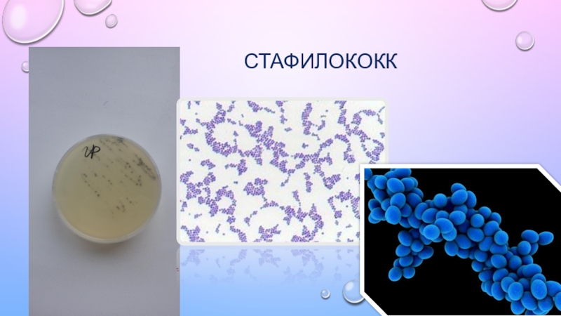 1 staphylococcus aureus. Сифилисный стафилококк. Staphylococcus aureus коагулазоположительный. Стафилококк картинки. Стафилококк под микроскопом.