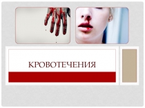 Сестринская помощь при кровотечениях