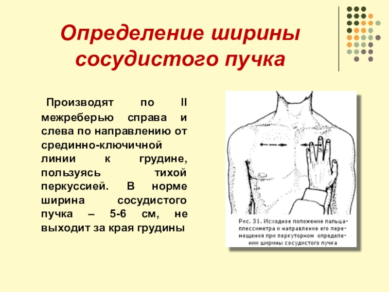 Сосудистый пучок. Ширина сосудистого пучка определяется. Измерение поперечника сердца и ширины сосудистого пучка.. Перкуссия сердца границы сосудистого пучка. Методика определения сосудистого пучка.