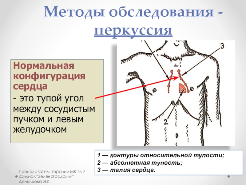 Схема перкуссия сердца