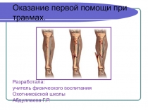 Презентация: Оказание первой помощи на уроке