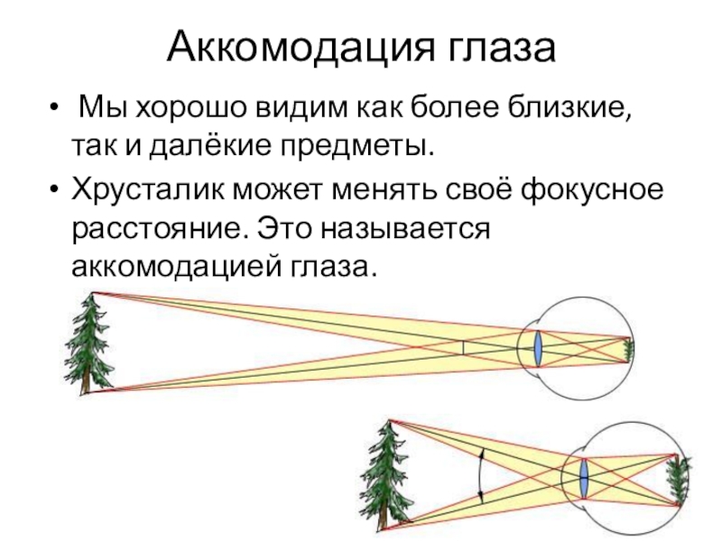 Поддержка аккомодации