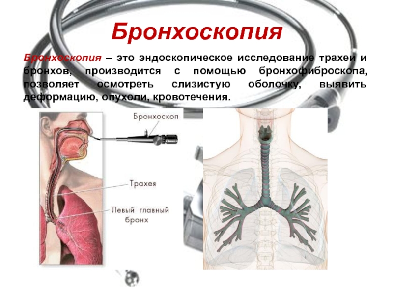 Схема бронхов эндоскопия