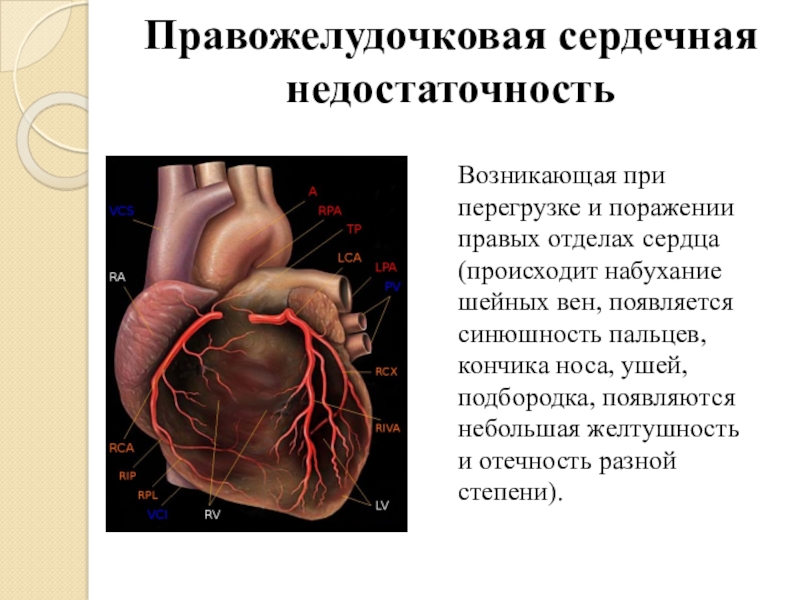 Презентация по обж первая помощь при острой сердечной недостаточности