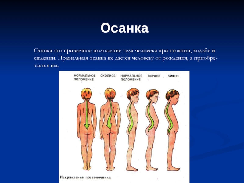 Значение правильной осанки в жизни человека проект