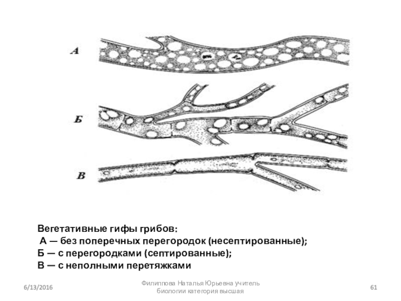 Вегетативные грибы. Несептированный мицелий. Септированный и несептированный мицелий. Септированный мицелий грибов. Септированный мицелий характерен для грибов.