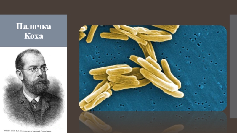 Палочка коха. Палочка Коха строение бактерии. Туберкулез палочка Коха рисунок. Палочка Коха 5 класс биология. Палочка Коха форма бактерии.