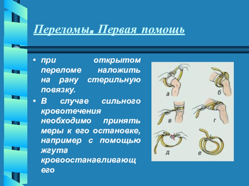 Первая помощь при повреждении скелета