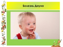 Презентация по биологии на тему Модификационная изменчивость