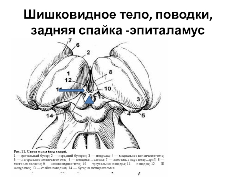 Разрыв задней спайки