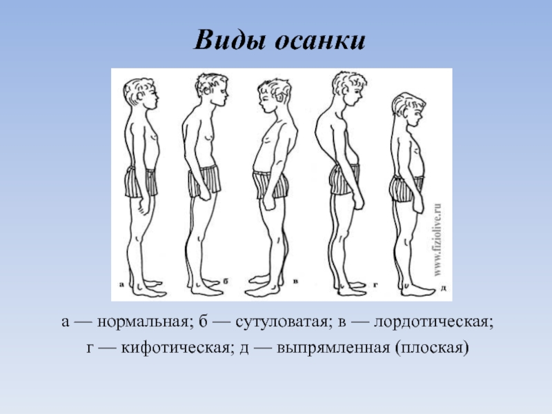 Какие нарушения осанки. Типы осанки по штаффелю. Типы нарушения осанки. Нормальный Тип осанки. Виды неправильной осанки.