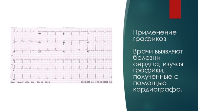 Применение графиков   Врачи выявляют болезни сердца, изучая графики, полученные с помощью кардиографа.
