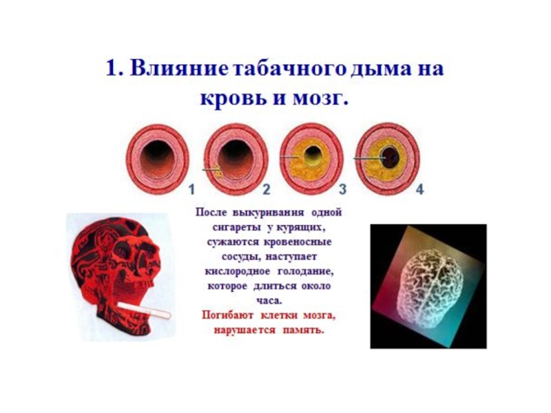 Влияние на сосуды. Влияние табачного дыма на кровь и мозг. Влияние никотина на кровеносные сосуды. Влияние табака на кровь.