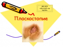 здоровьясбережения Плоскостопие