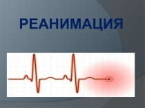 Презентация по ОБЖ Сердечно-легочная реанимация