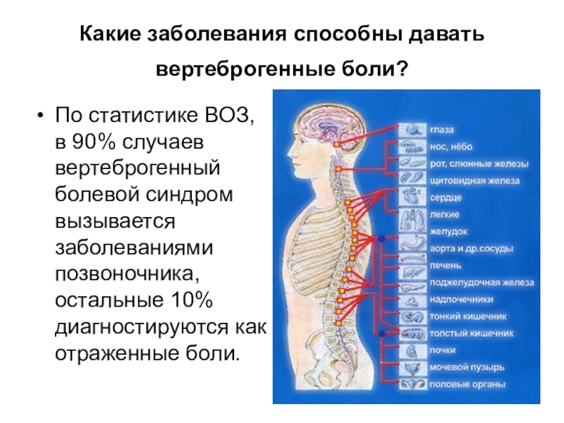 От какого позвонка что болит картинка