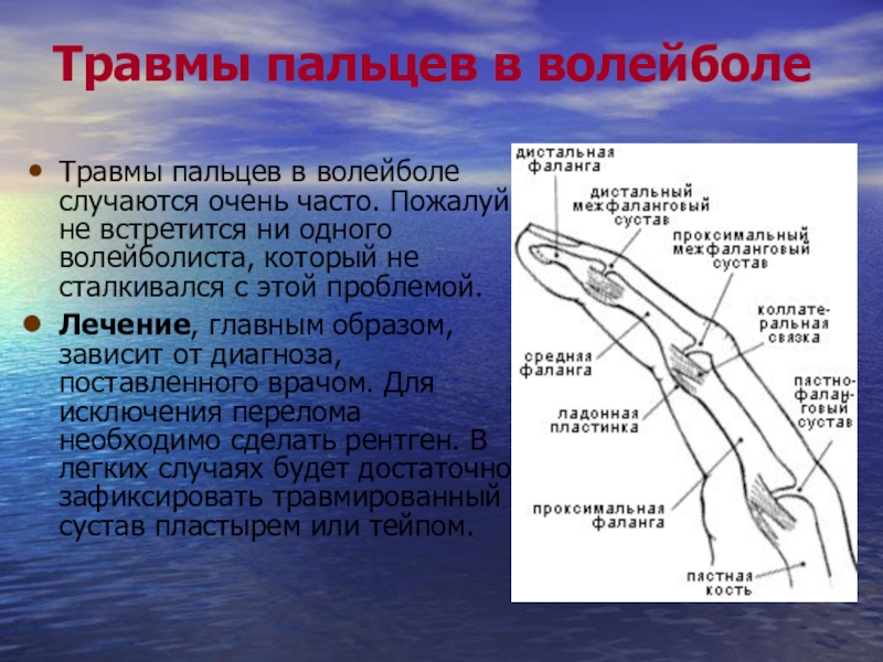 Травмы в волейболе презентация