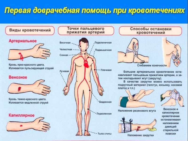 Первая медицинская помощь при кровотечениях реферат. Первая помощь при кровотечениях таблица. Буклет первая помощь при кровотечениях. Таблица по биологии первая помощь при кровотечениях. Вид кровотечения, при котором в качестве первой помощи применяют жгут.