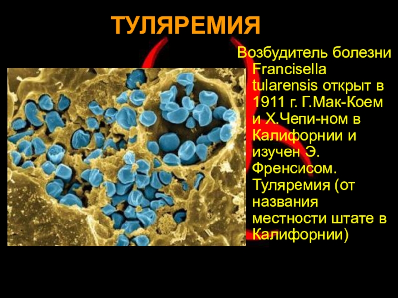 Возбудитель туляремии рисунок