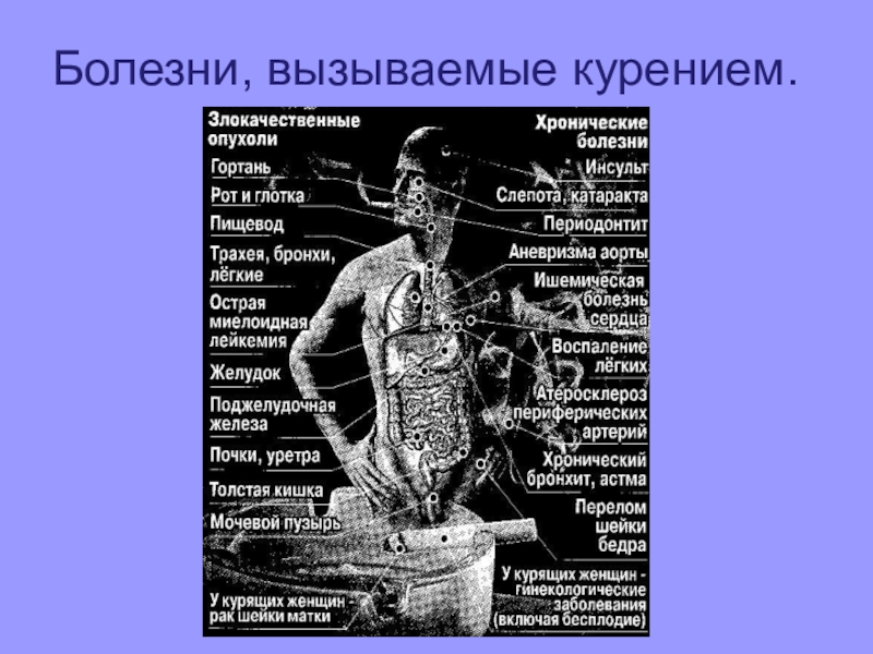 Какие болезни дают. Болезни вызываемые табакокурением. Заболевания вызванные курением. Болезни вызванные кремнием. Заболевания вызываемые сигаретами.