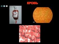 Презентация для урока химии в 11 классе по теме Дисперсные системы