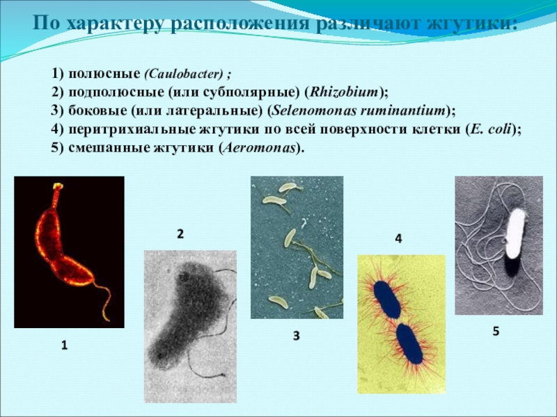 Размер жгутика. Строение жгутиков бактерий. Подполюсные жгутики. Строение жгутика у жгутиконосцев. Расположение жгутиков у бактерий.