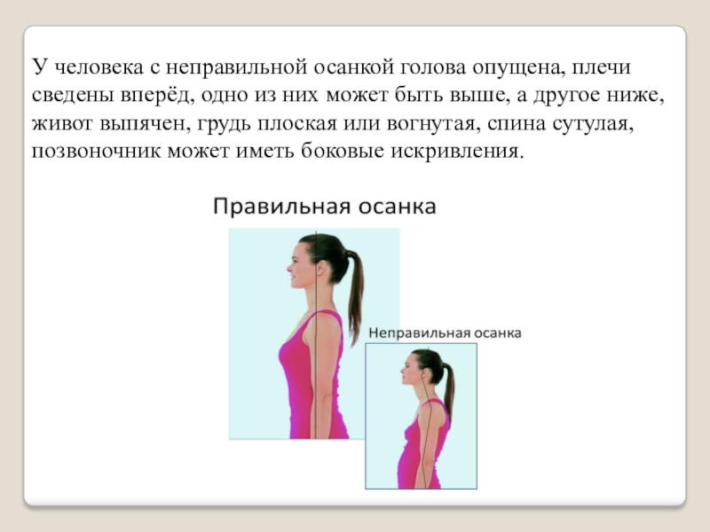 Плечи низко опущены. Человек с неправильной осанкой. Осанка голова вперед. Живот из за неправильной осанки. Голова вперед неправильная осанка.