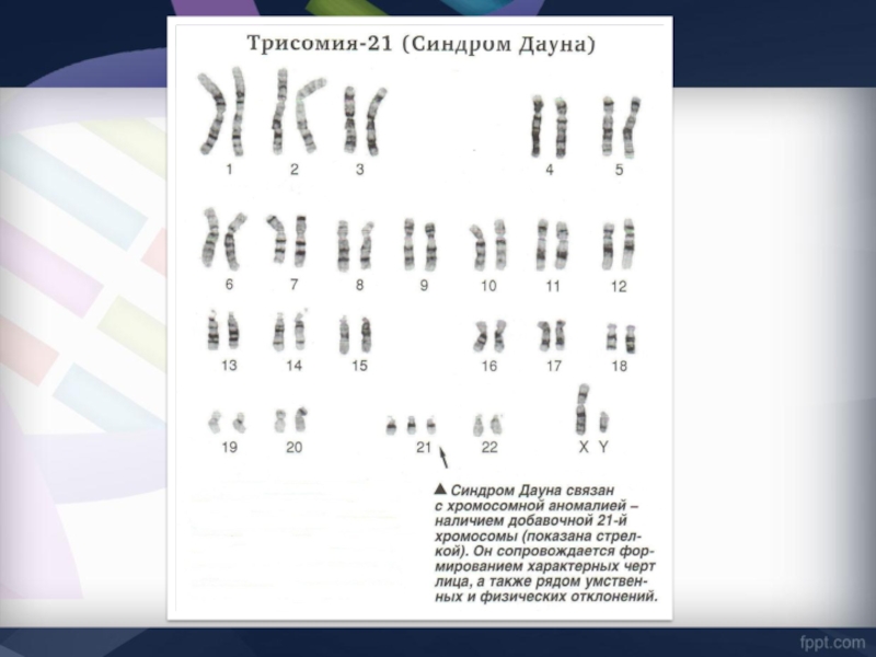 Генетика синдром дауна презентация