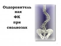 Презентация по физической культуре на тему Оздоровительная физическая культура при сколиозах