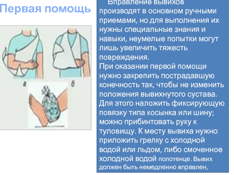 Первое вывихивающее движение при удалении. Оказание помощи при вывихе. Первая помощь при вывихе. Оказание первой помощи при вывихе плеча.