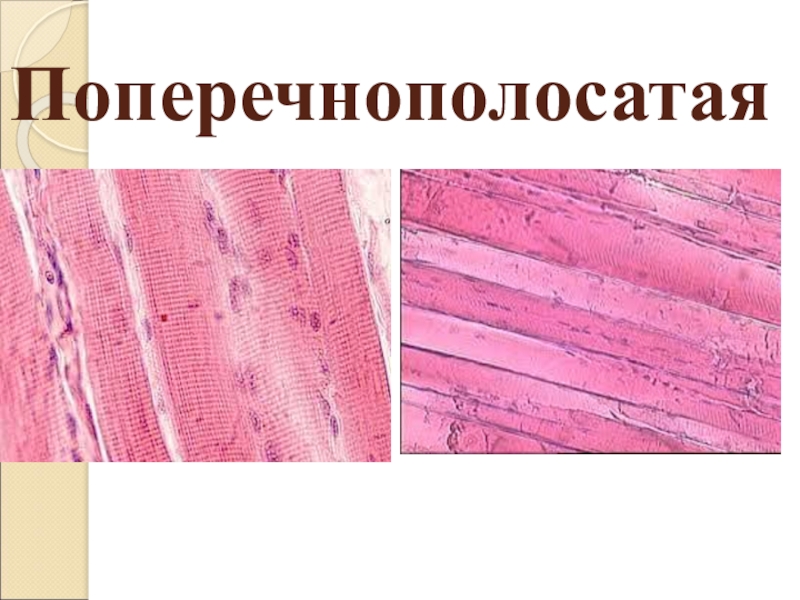 Поперечная ткань. Поперечнополосатая Скелетная ткань. Поперечнополосатая Скелетная мышечная ткань. Исчерченная поперечнополосатая Скелетная мышечная ткань. Поперечнополосатая мышечная ткань микроскоп.