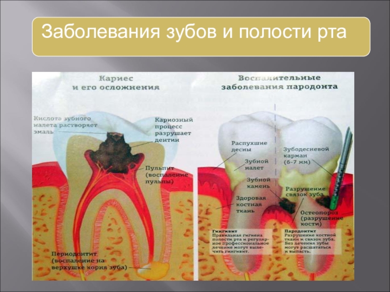 Рассмотрите рисунки с изображением зуба человека как называется заболевание зуба