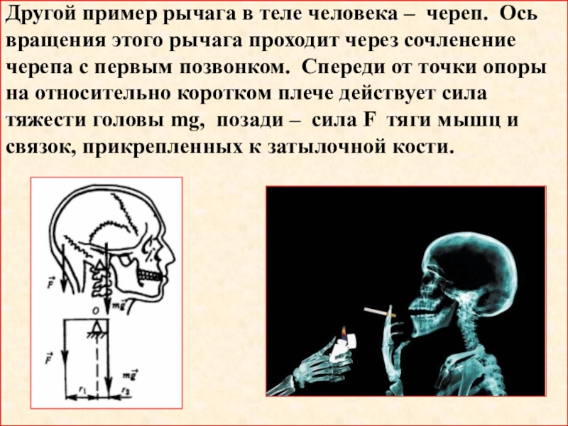 Другой пример рычага в теле человека – череп. Ось вращения этого рычага проходит через сочленение черепа с