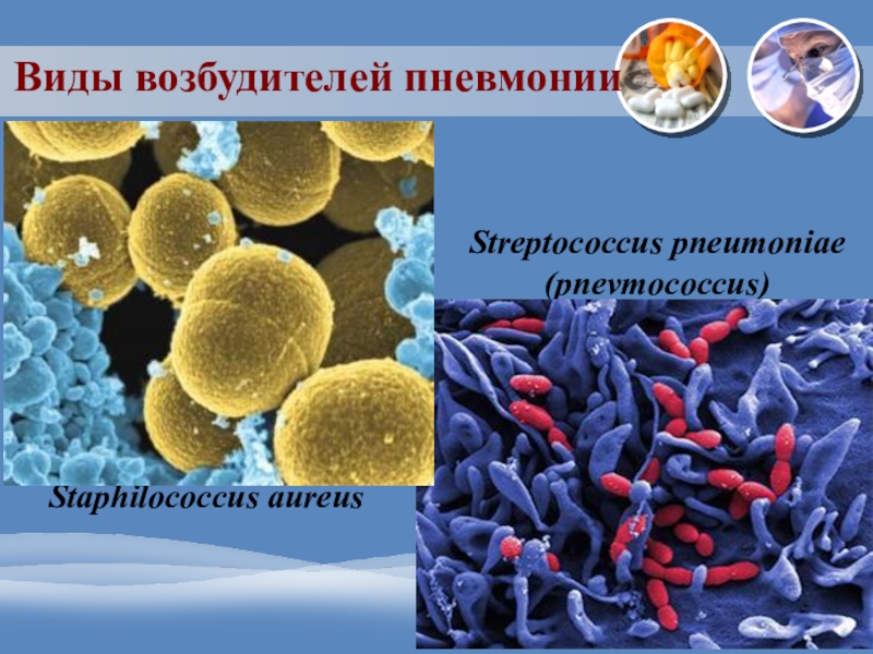 Возбудитель пневмонии. Стрептококк ауреус возбудитель. Возбудители пневмонии. Бактериальная пневмония возбудители. Типичные возбудители пневмонии.