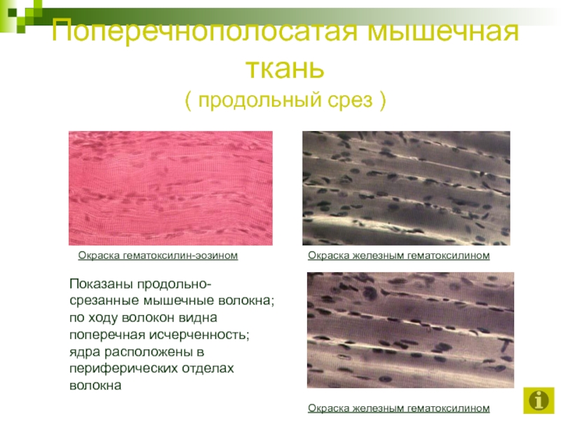 Скелетная мышечная ткань гистология рисунок