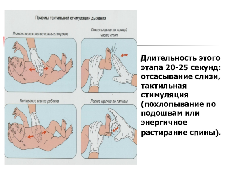 Тактильная стимуляция дыхания