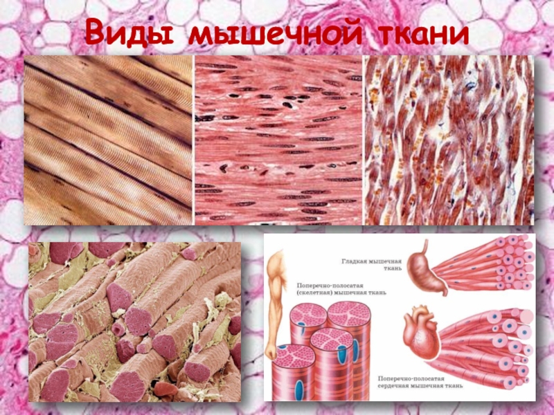 Мышечные ткани человека. Рисунок мышечной ткани человека 8 класс. Разновидности мышечные ткани место. Какой Тип мышечной ткани лишний.