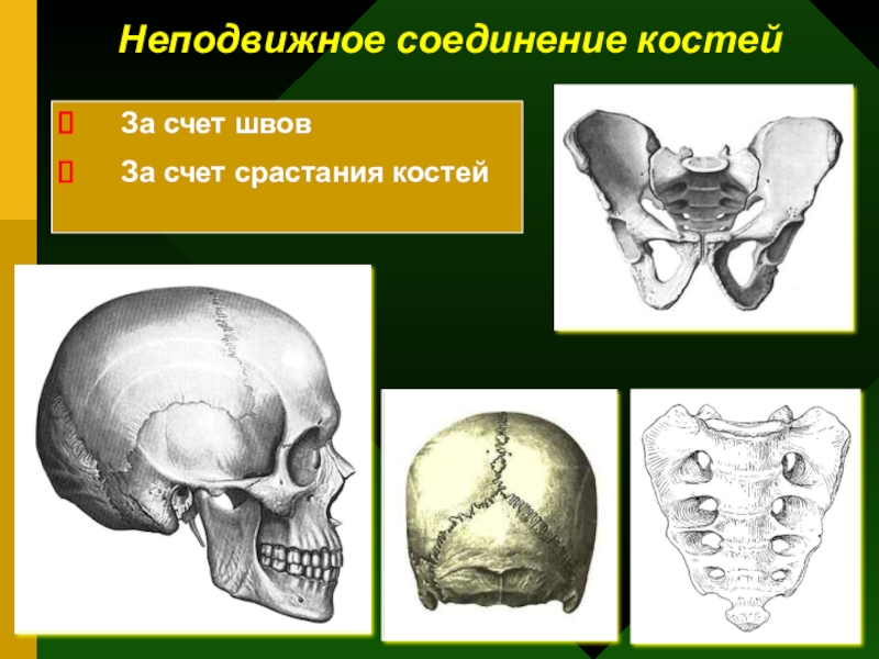 Подвижное соединение между костями. Неподвижное соединение костей. Не подвижной соединение костей. Неподвижное соединение костей это соединение. Неподвижное соединение костей таза анатомия.