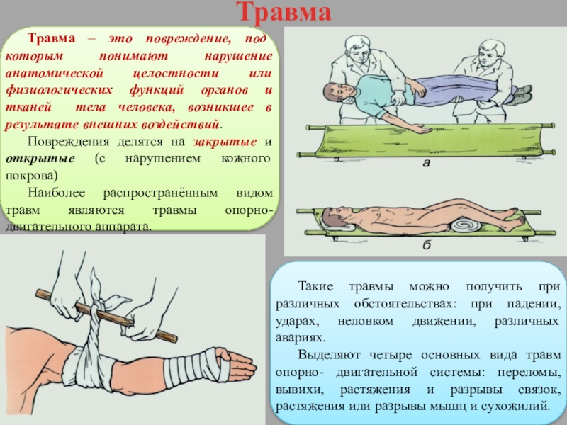 Ушибы презентация по обж