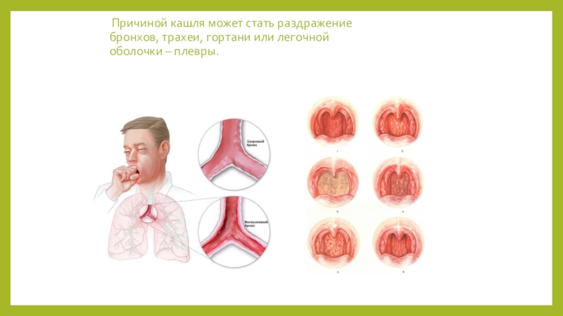 Поражения трахеи. Трахеит верхних дыхательных путей.