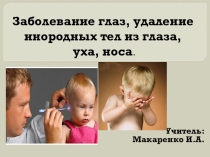 Заболевание глаз, удаление инородных тел из глаза, уха и носа