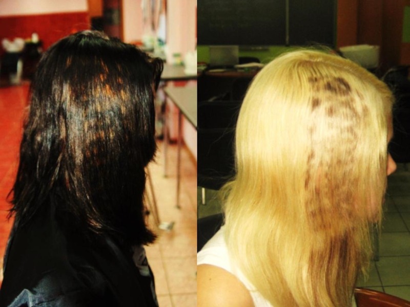 Можно ли осветлять волосы при псориазе